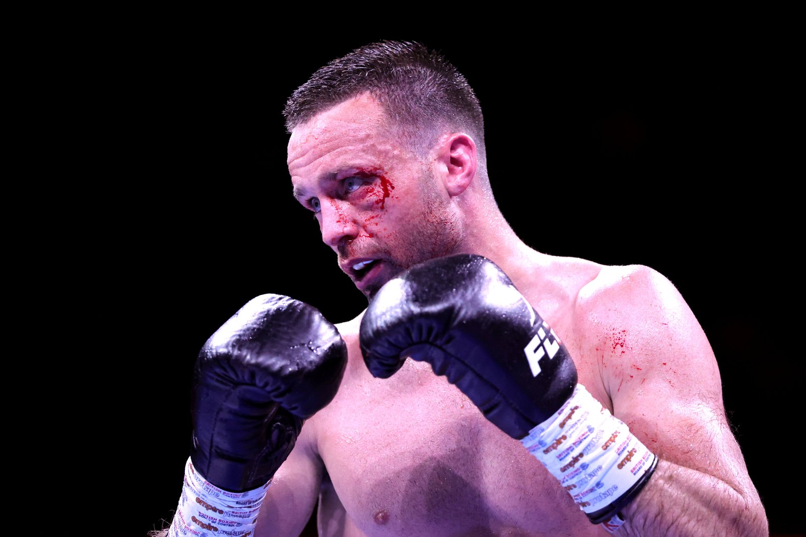 Josh Taylor has had to bow out of boxing due to a recurring eye injury