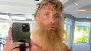 Logan Paul shows off new look amid WWE absence