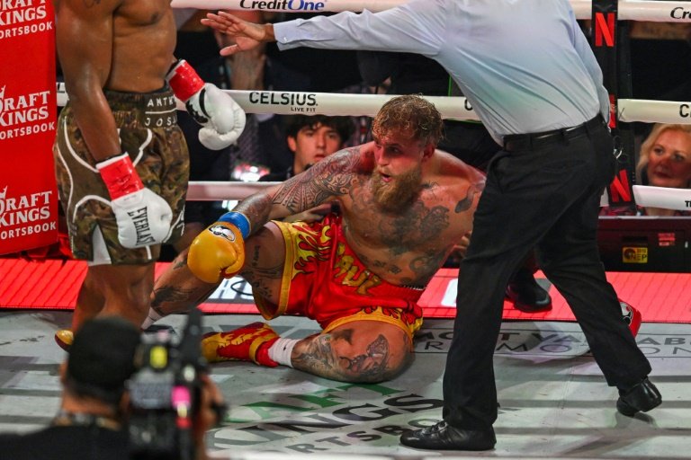 Jake Paul requires second jaw surgery after Joshua knockout