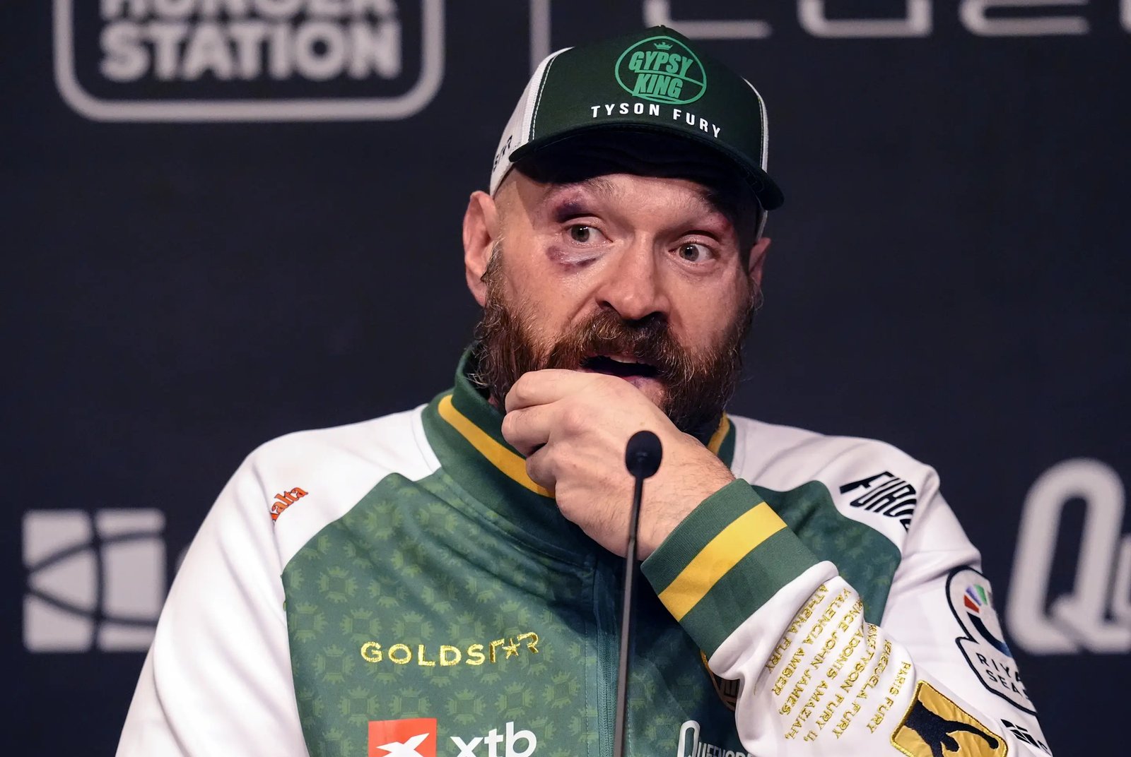 Tyson Fury during a press conference following his defeat to Oleksandr Usyk at the Kingdom Arena in Riyadh, Saudi Arabia. Picture date: Saturday December 21, 2024. (Photo by Nick Potts/PA Images via Getty Images)