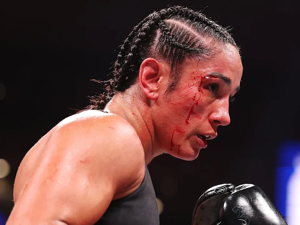 The legendary Amanda Serrano is the biggest name on MVP’s impressive female roster (Getty for Netflix)