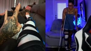 Post-Surgery Update: Injured WWE Champion Rhea Ripley